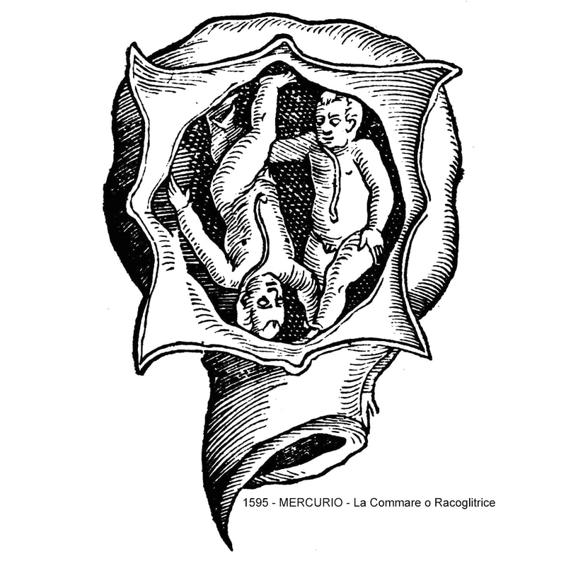 Fanciful drawing of twins in-utero from Mercurio's 1595 book.